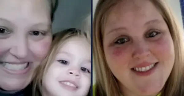 Callie Brunett met Erin Brunett