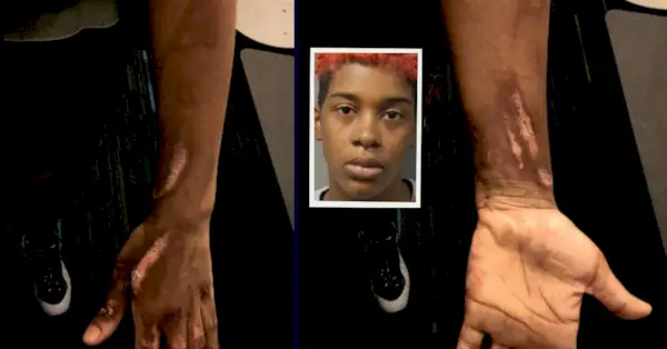 קימברלי טיילר