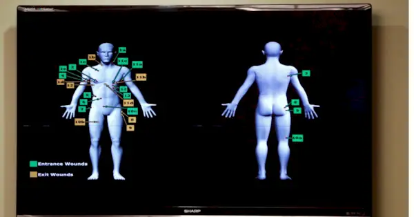 Доказательства огнестрельного ранения, касающиеся Майка МакЛелланда во время судебного процесса по делу об убийстве Эрика Уильямса в здании суда округа Рокволл в Рокволле, понедельник, 1 декабря 2014 года. (AP Photo/The Dallas Morning News, Вернон Брайант, Пул)